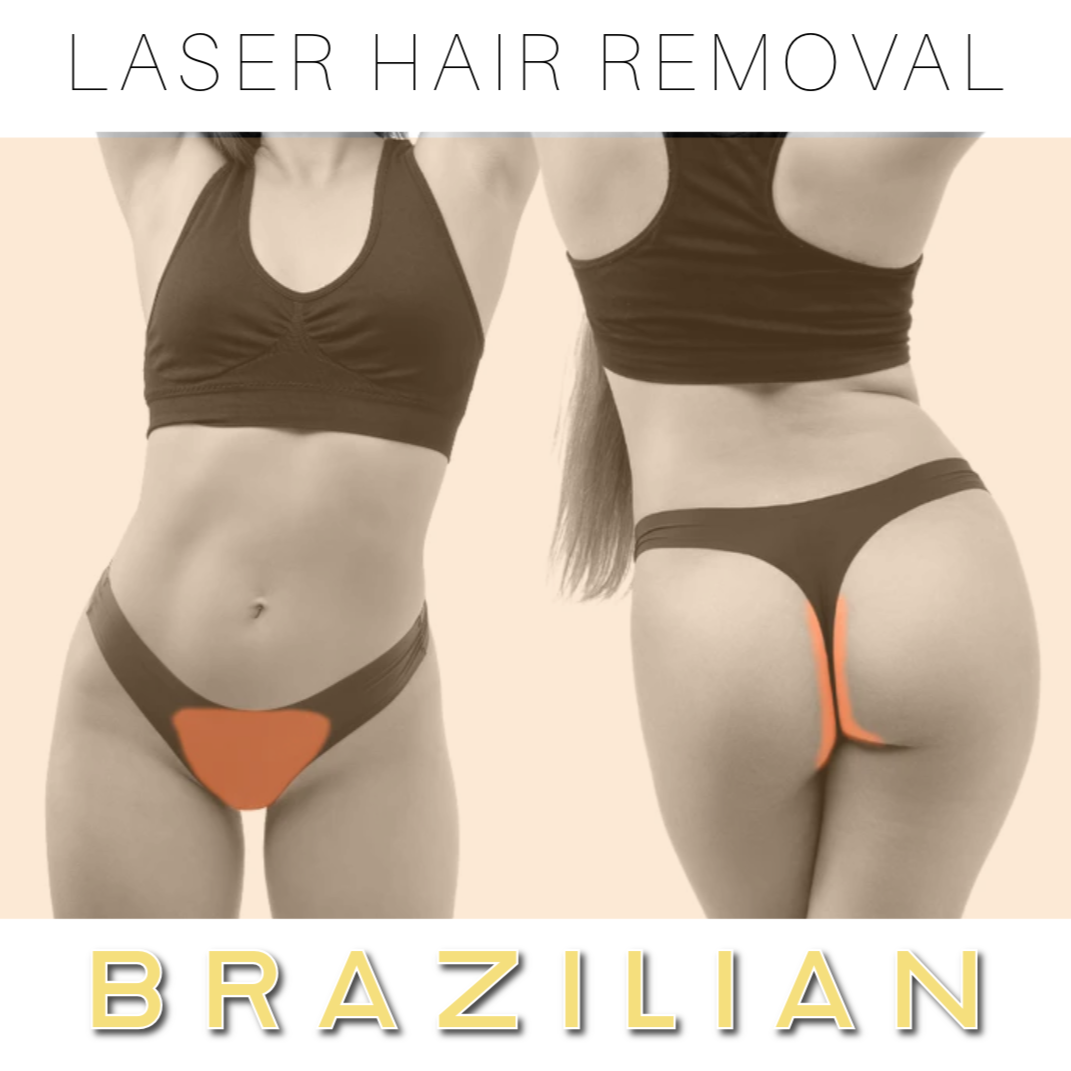 Laser Hair Removal Brazilian Near Me Laser Hair Removal Brazilian Near Me