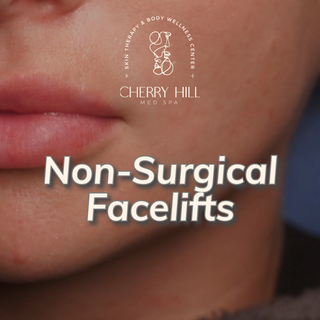 Non-Surgical Face Lifts