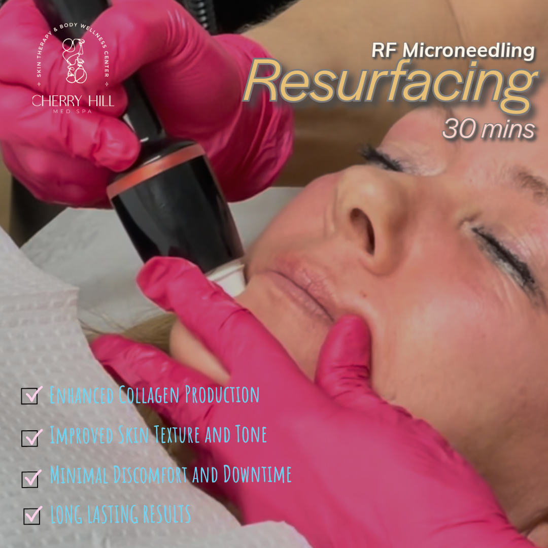 Resurfacing RF Microneedling