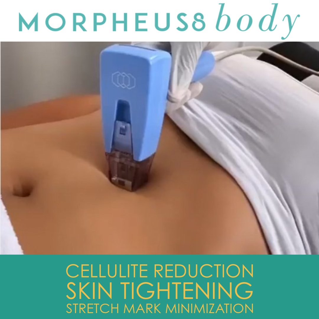 Morpheus8 Body Treatments