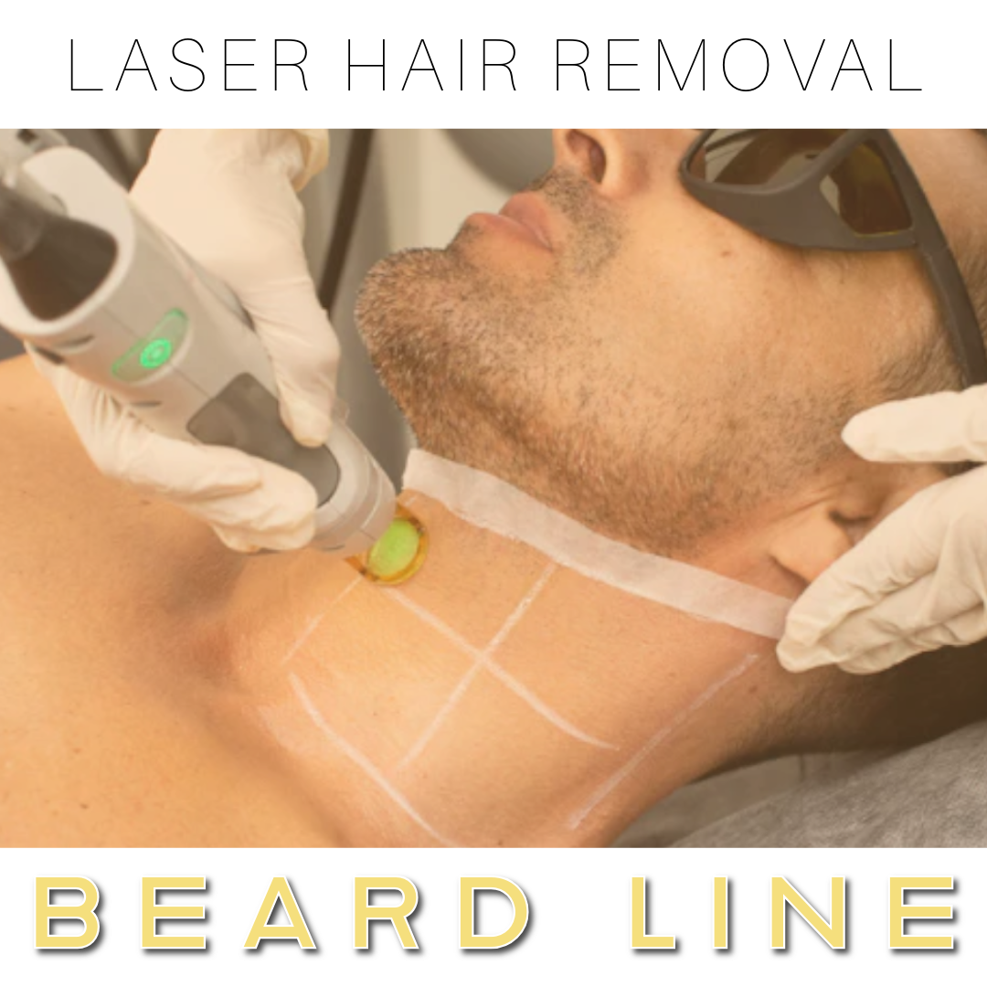 Beard Line (Fine Tune Hair Shaping) - Laser Hair Removal Treatment