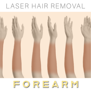 Forearm - Laser Hair Removal