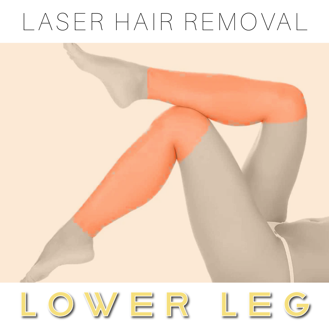 Lower Legs - Laser Hair Removal