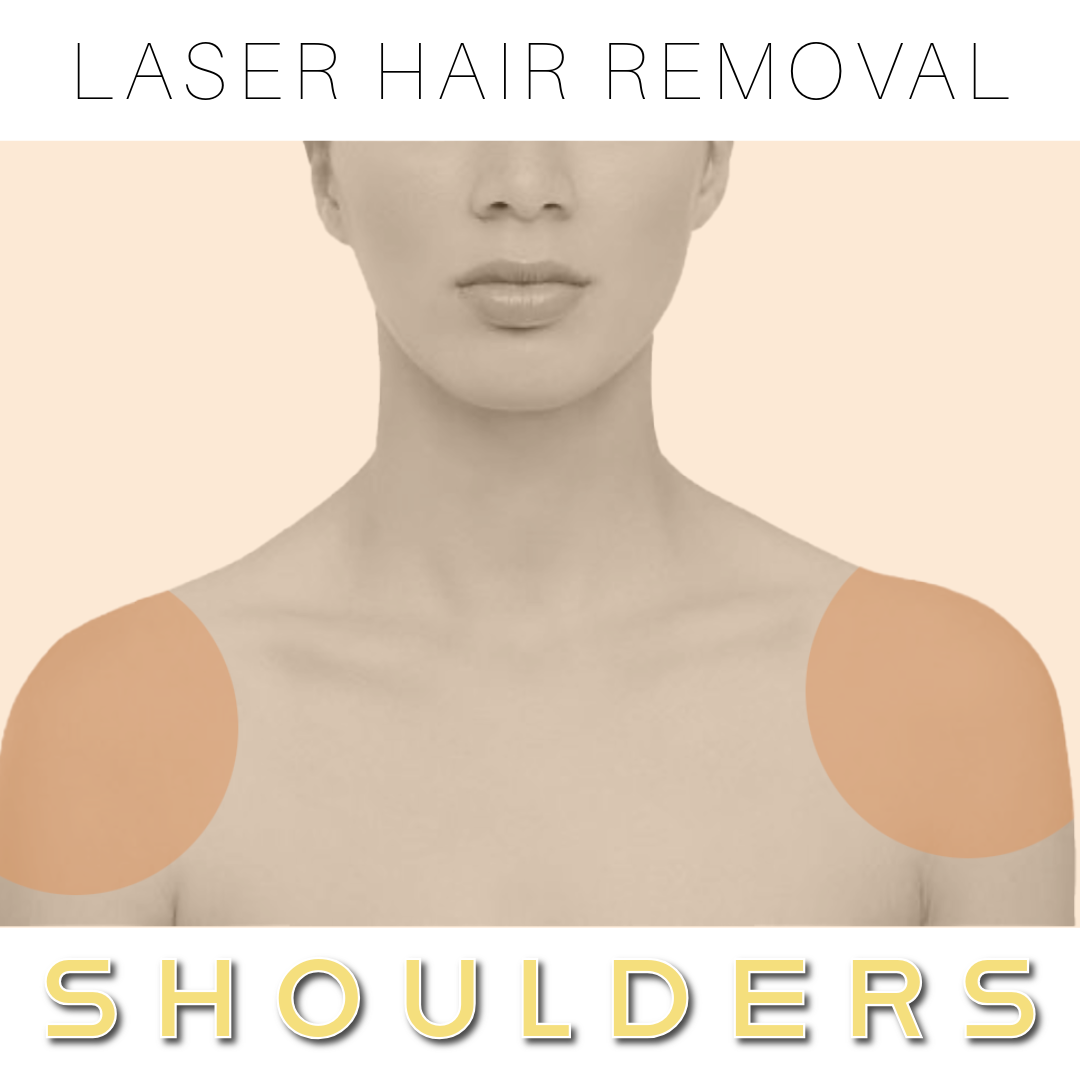 Shoulder - Laser Hair Removal