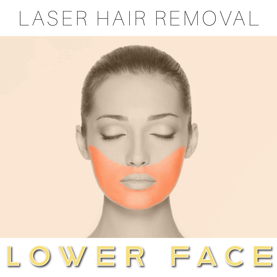 Lower Face - Laser Hair Removal