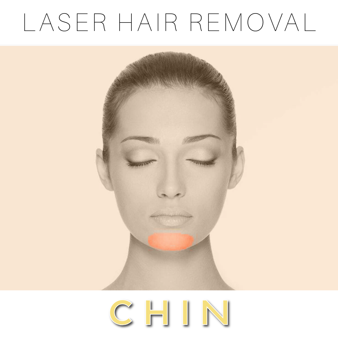 Chin Laser Hair Removal