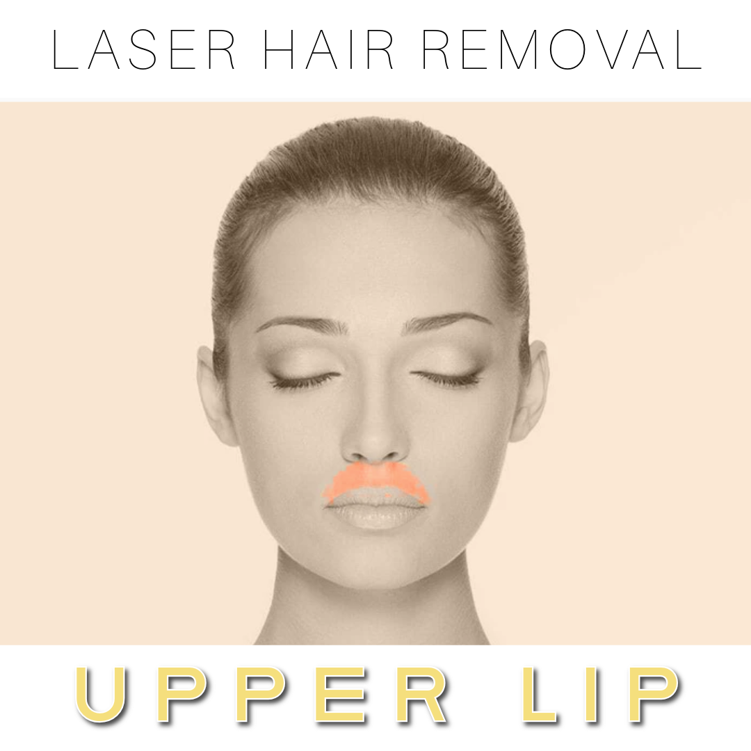 Upper Lip Laser Hair Removal