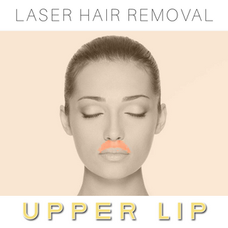 Upper Lip Laser Hair Removal