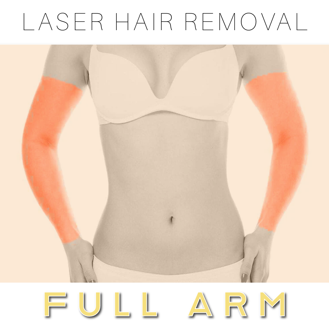 Arms - Laser Hair Removal