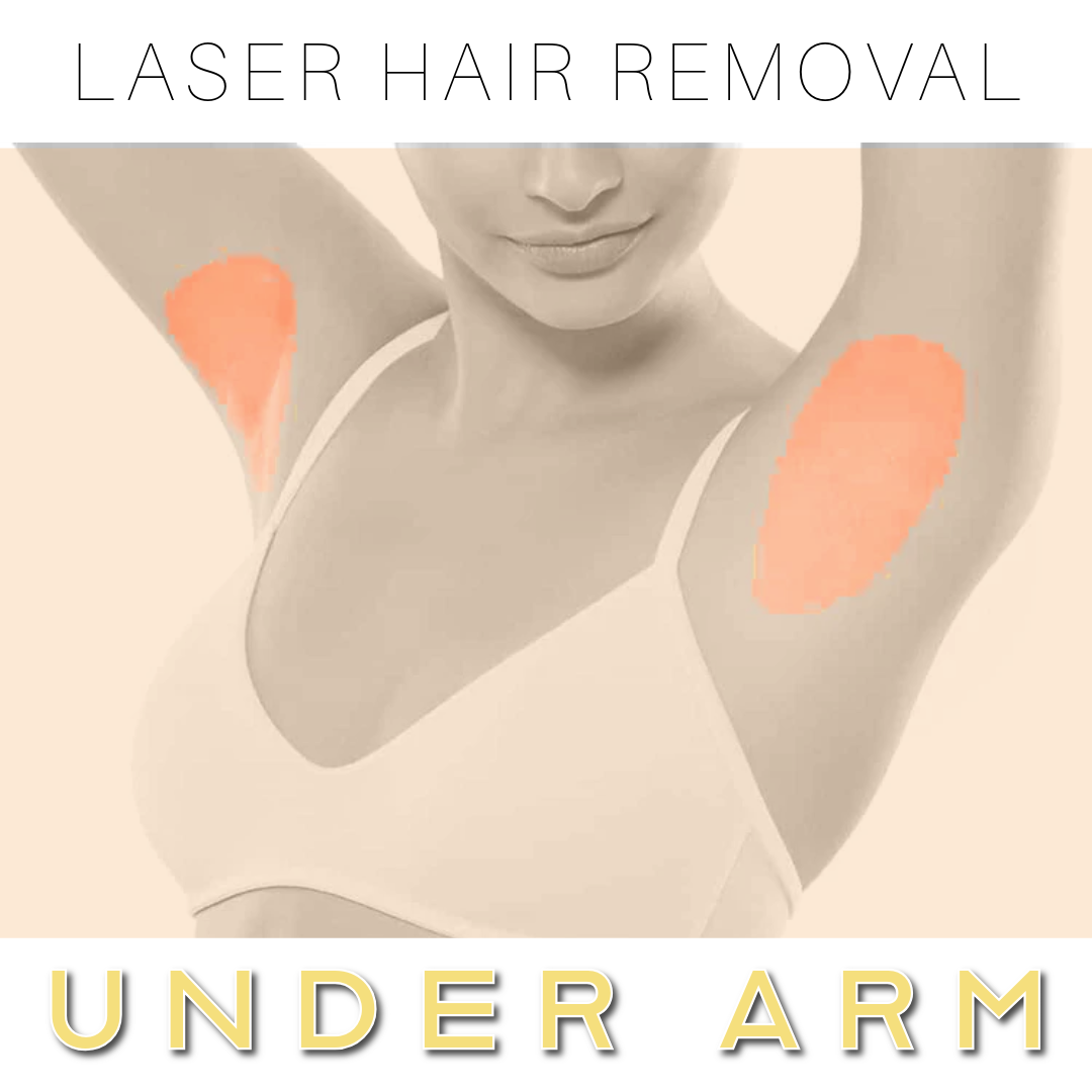 Under Arm Laser Hair Removal