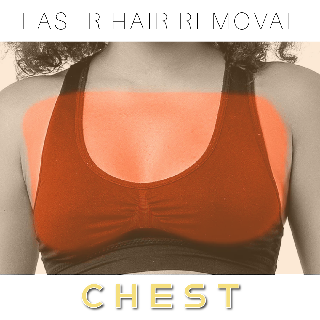 Chest - Laser Hair Removal