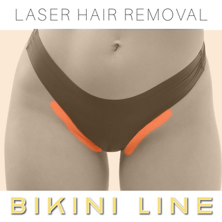 Bikini Line - Laser Hair Removal