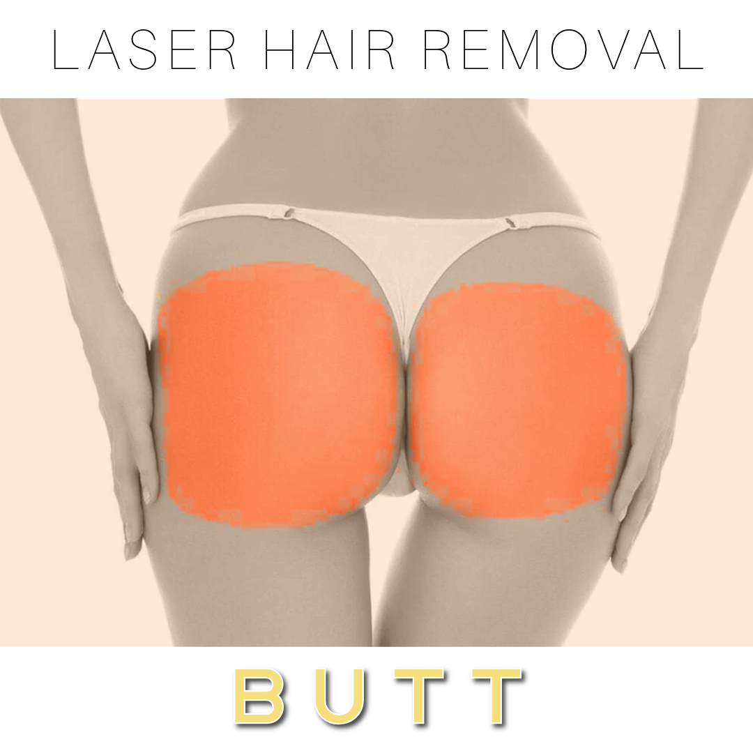 Butt - Laser Hair Removal