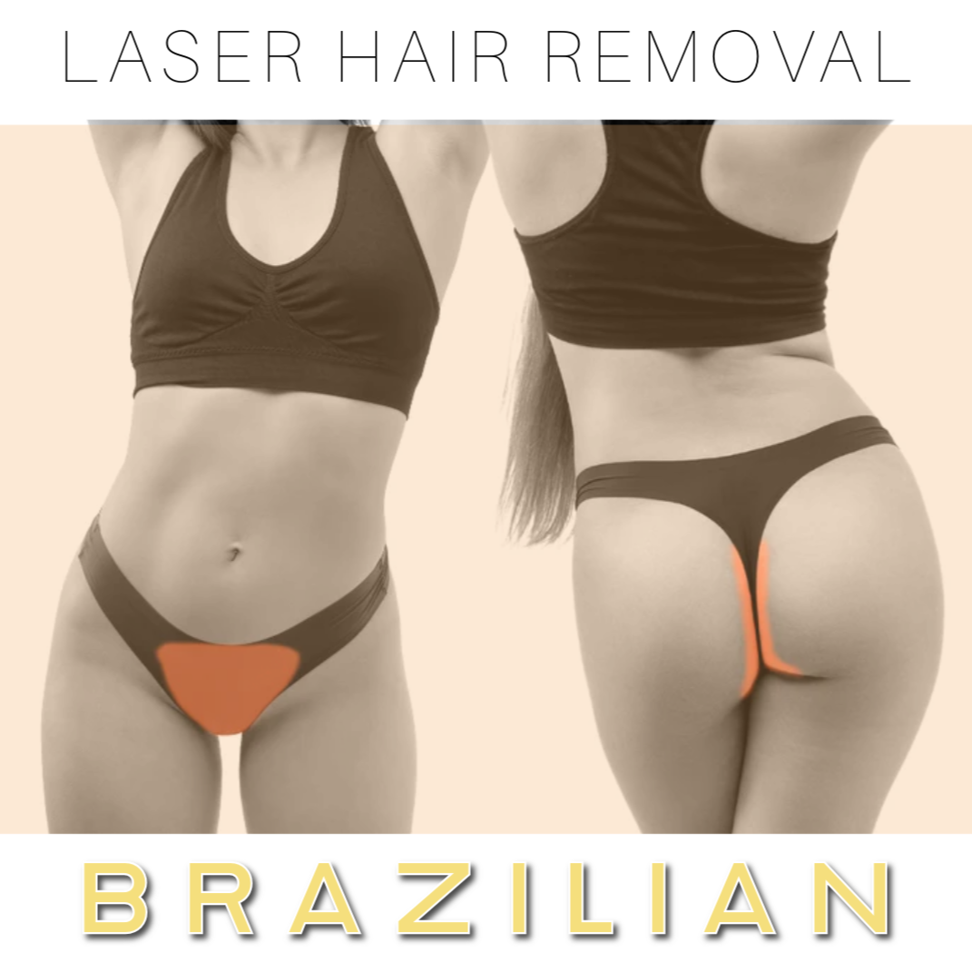 Brazilian - Laser Hair Removal