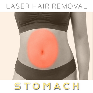 Stomach -  Laser Hair Removal