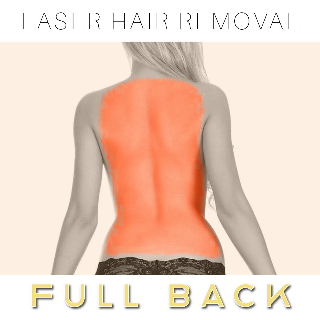 Back -  Laser Hair Removal