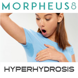 Hyperhydrosis Morpheus8 3 Treatment Package